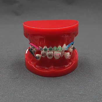 Модель зубов с брекетами, стоматологические материалы, Ортодонтические модели десен, зубы для изучения, обучения, воспитания пациентов